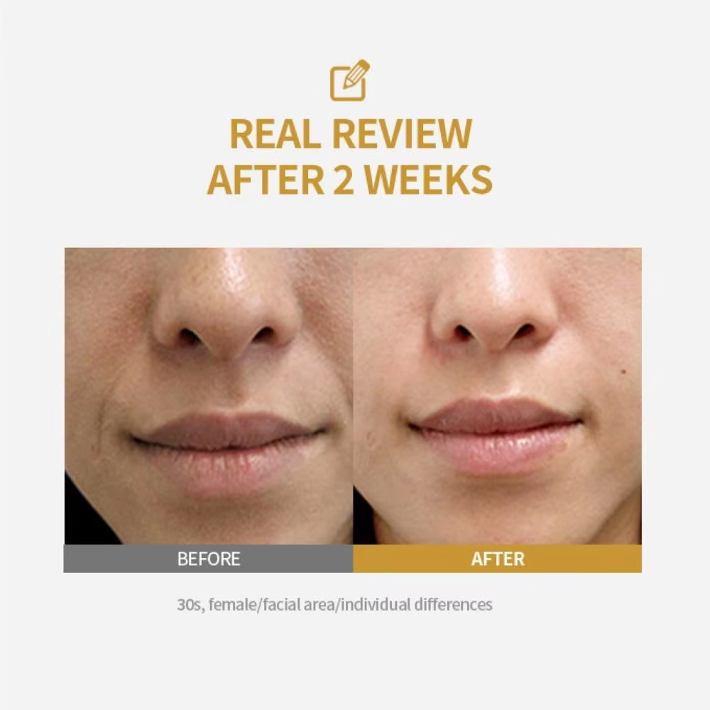 เปปไทด์ อินเทนซีฟ ลิฟติ้ง แอมพ - Collagen Peptide Powder บทวิจารณ์และราคา