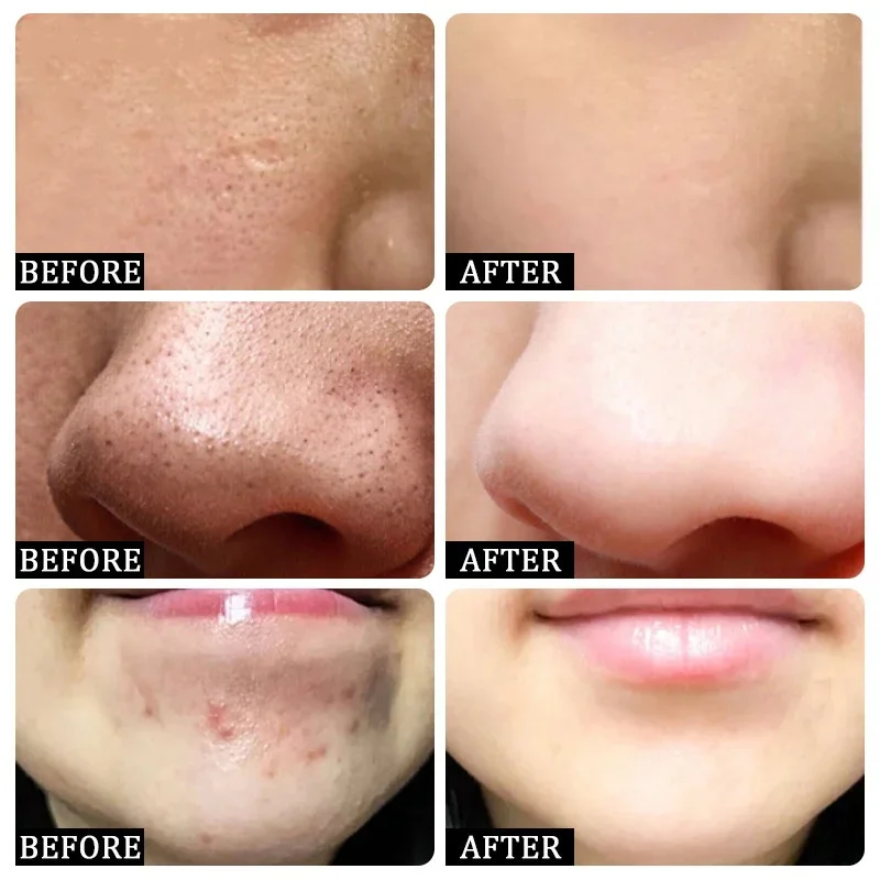 Salicylic Acid Pore Clearing C - Collagen Peptide Powder บทวิจารณ์และราคา