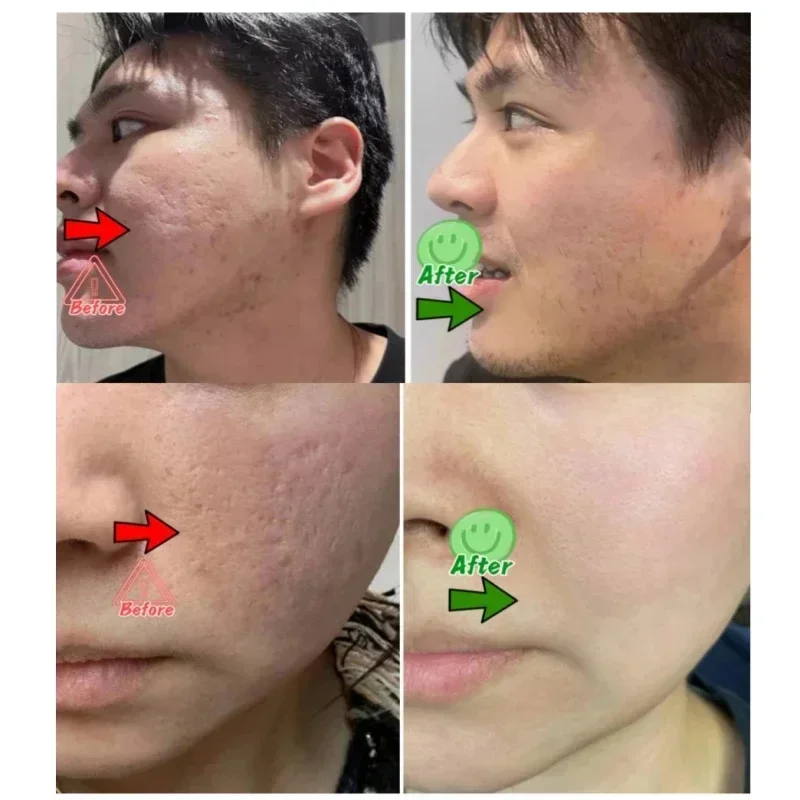 Salicylic Acid Pore Clearing C - Collagen Peptide Powder บทวิจารณ์และราคา