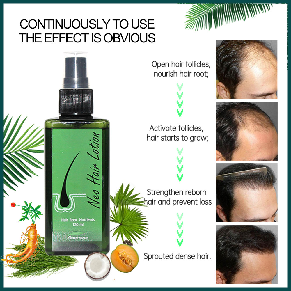 โลชั่นบำรุงผม Neo Hair Lotion  - Biotin Hair Growth บทวิจารณ์และราคา